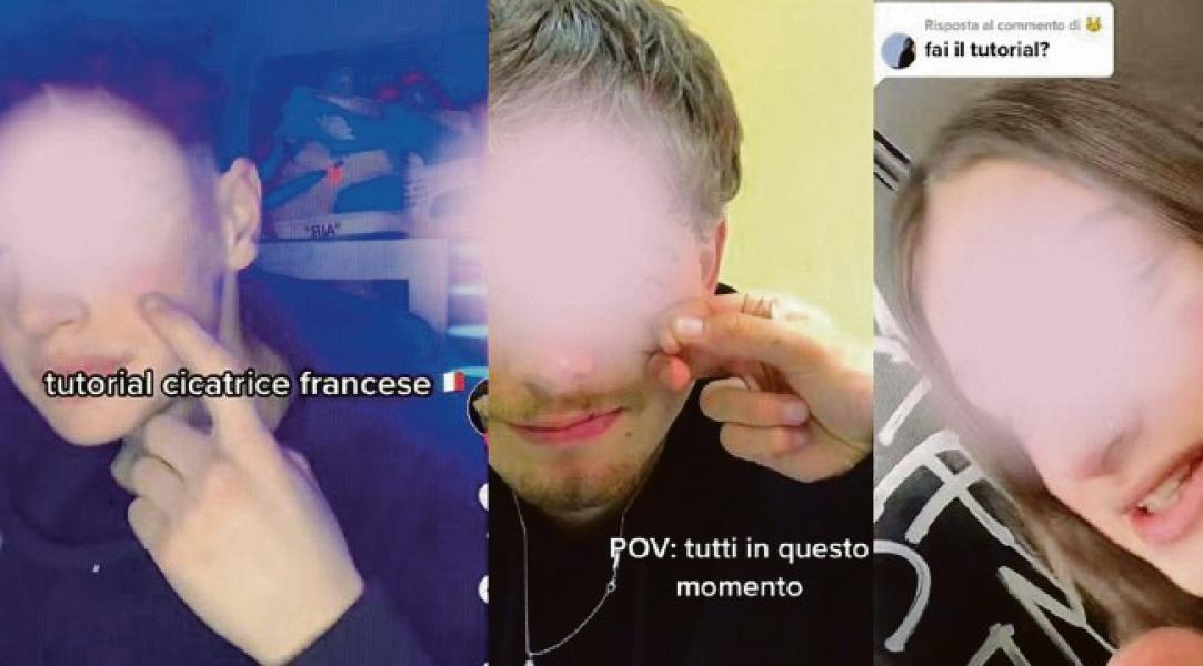 «Cicatrice francese» TikTok nel mirino, parla Balzano: «È la risposta a un disagio»