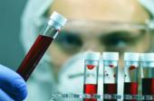 Salute, comuni abitudini che falsano esami e test, medici svelano quali sono