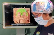 Bari, al Policlinico la tecnologia 3D per ricostruire chirurgicamente il volto dopo gravi traumi