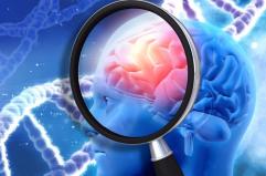 L'Universit&agrave; di Bari partecipa a uno studio che svela quali sono le &laquo;spie&raquo; nel cervello per le malattie neurologiche