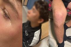 Calcio, arbitro 15enne aggredito durante partita Under 16 tra Ginosa e Laterza: l’AIA denuncia episodio di violenza