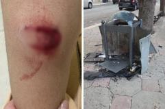 Bitonto, a Capodanno petardi contro i passanti e cassonetti distrutti: &laquo;Ragazzi senza controllo&raquo;