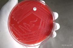 Andria, uomo morto dopo aver mangiato carne cruda: indagini su possibile contaminazione da listeria. Nel mirino una macelleria