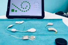 Al Policlinico di Bari impianto cocleare smart, bimbo di 11 recupera udito