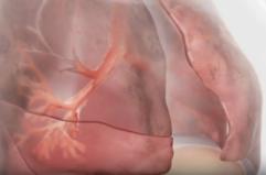 Innovazioni terapeutiche nella BPCO con enfisema