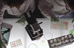 Chiarito il legame tra lupus e rischi cardiovascolari