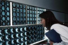 Radiologi Sirm: "Attenzione a medicina difensiva ed esami inappropriati"