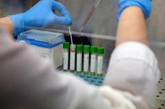 Medicina, italiani svelano errori nascosti nelle cellule: "Possibile ruolo in più malattie"