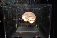 Medicina, neurologi: "L'innovazione può cambiare la storia di molte malattie ma serve equità"