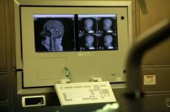 Medicina: Congresso Sin, neurologia tra innovazione, responsabilità e nuova organizzazione Medicina: Congresso Sin, neurologia tra innovazione, responsabilità e nuova organizzazione