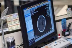 Salute, Padovani (Sin): "Longevità aumenta rischio Alzheimer, agire su prevenzione" Salute, Padovani (Sin): "Longevità aumenta rischio Alzheimer, agire su prevenzione"