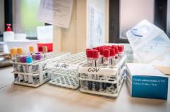 Medicina di laboratorio, 'un semplice esame per scoprire in anticipo le patologie'