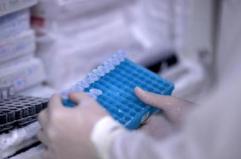 Scoperto il virus gigante Ushikuvirus, lo studio: "Pu&ograve; darci indizi su origine della vita"