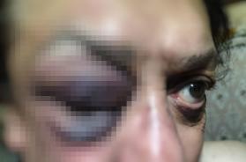 Aggressione omofoba a San Giovanni Rotondo: 57enne preso a calci e pugni da due ragazzini Aggressione omofoba a San Giovanni Rotondo: 57enne preso a calci e pugni da due ragazzini