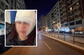 Bari, 24enne su un monopattino presa a martellate da un automobilista: l'aggressione shock