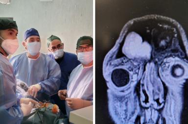 Bari, 37enne recupera la vista dopo un intervento d’urgenza al Policlinico: aveva una grave complicanza sinusale Bari, 37enne recupera la vista dopo un intervento d’urgenza al Policlinico: aveva una grave complicanza sinusale