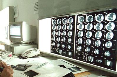 Lotta ai tumori: servizio sanitario promosso ma con differenze regionali