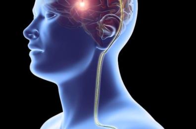 Resettami Parkinson, c'è anche il Politecnico di Bari per l'avatar che cura il Parkinson