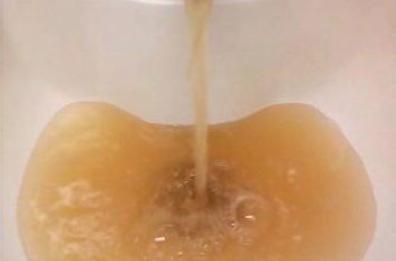 «Acqua gialla al Perrino
l'Asl renda noto
l'esito dei controlli»