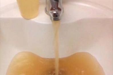 «Nessun rischio legato
all'acqua dell'ospedale»