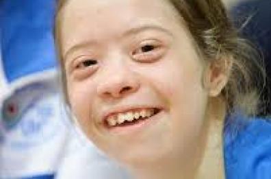 Sindrome di Down, eppur si muove!