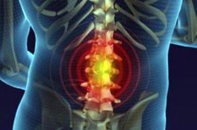 Spondiloartrite assiale, patologia infiammatoria della colonna vertebrale