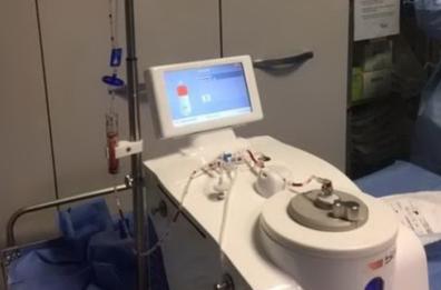 Lecce, autotrapianto cellule staminali salva piede a un diabetico