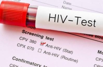 Puglia, allarme Aids: un contagio ogni due giorni