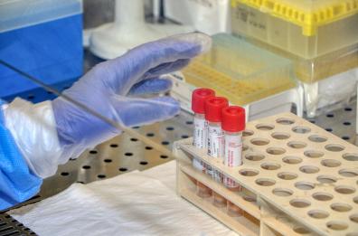 Coronavirus, anche l'eparina è in fase sperimentale: in Puglia a San Giovanni Rotondo