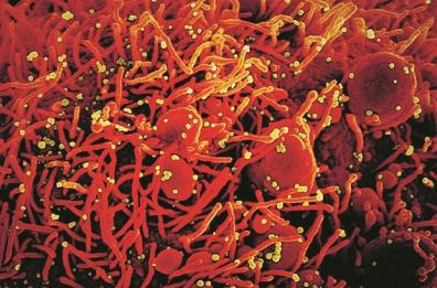 Quando il Pianeta &egrave; sotto infezione