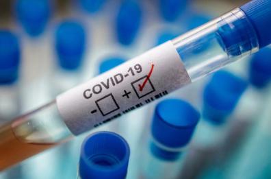 Coronavirus, l'esperta Chironna: «Prudenza ora, o la sanità sarà al collasso»