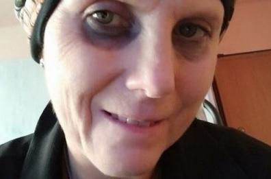 E la madre diede il sangue per la figlia misconosciuta