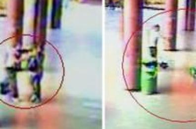 Autopsia romena: trauma dovuto a caduta