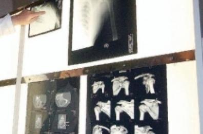 Matera, un virus distrugge le foto di 821 referti diagnostici