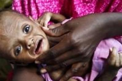 Unicef,ogni giorno muoiono 21 mila bimbi
