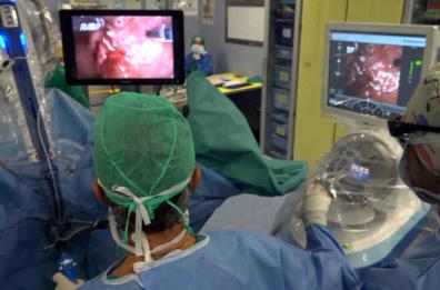 Foggia, una ricerca isola le cellule maligne del tumore al colon-retto: lo studio dall'ospedale di San Pio 