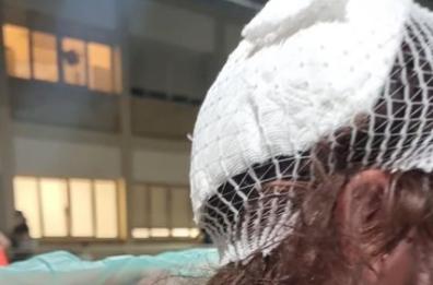 Insulti omofobi e una pietra in testa: aggressione a Bari nel Parco Rossani dopo il Pride. Oggi presidio davanti all'ex Caserma