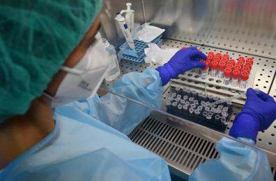 Covid, ecco il nuovo test affidabile e rapido ideato da tre donne baresi