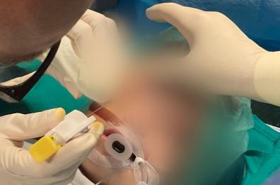 Corsano, si rovescia addosso acqua bollente: grave una bimba di un anno