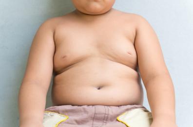 Obesità, il 50% dei pugliesi è in sovrappeso: problemi per il 37% dei bimbi
