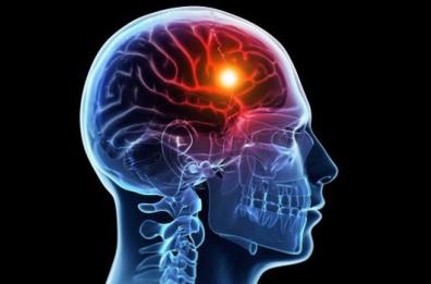 Aprile è il mese per la prevenzione contro l’ictus cerebrale
