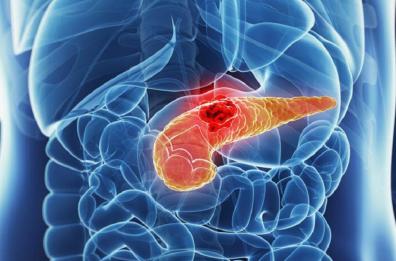 Tumore al pancreas, studio Uniba su farmaci per superare chemioresistenza