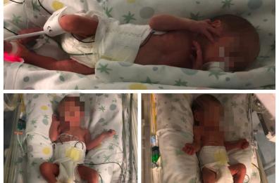 Bari, triplo fiocco all'ospedale Di Venere: nati 3 gemellini Rebecca, Alessia e Nathan Francesco 
