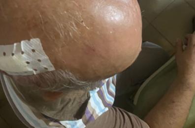 Paura per il salentino don Fernando Doria, aggredito in Madagascar