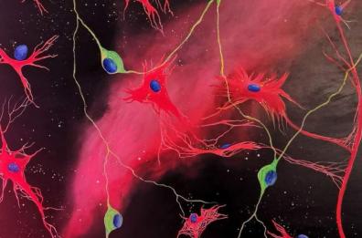 Le cellule tumorali diventano arte: una lucana trasforma in dipinti i neuroblastoma