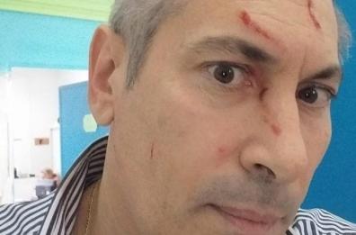 Preside aggredito a Taranto, è polemica: «Avviso orale a genitori era l'unico strumento»