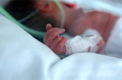 Neonato prematuro estubato a Foggia con una tecnica innovativa
