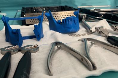 Chirurgia maxillo-facciale: a Bari ricostruzioni ossee 3D per ridurre i tempi degli interventi