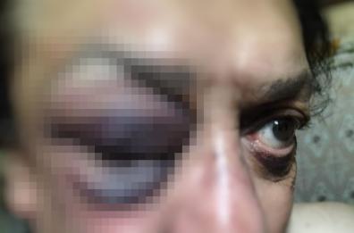 Aggressione omofoba a San Giovanni Rotondo: 57enne preso a calci e pugni da due ragazzini