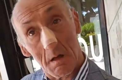 Bari, uno sconosciuto scende dalla moto e prende a pugni «Cerino»: l'aggressione, poi la fuga